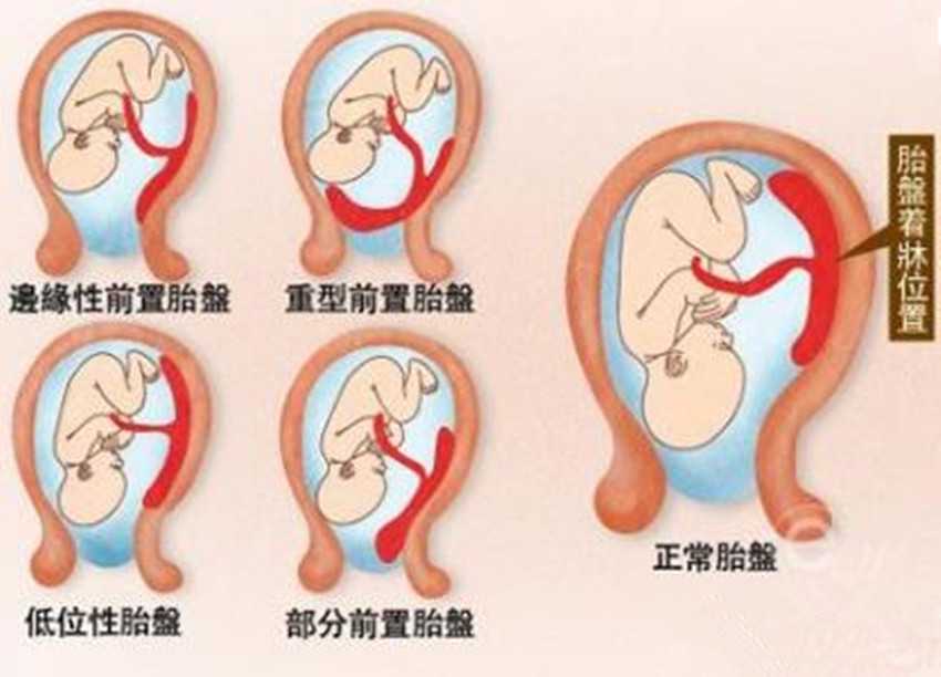 东莞代生公司助孕,试管胚胎冷藏再换会对宝宝的身心健康有影响吗